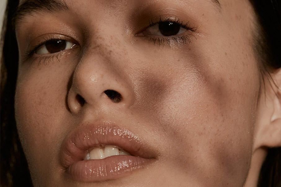 Pigmentation